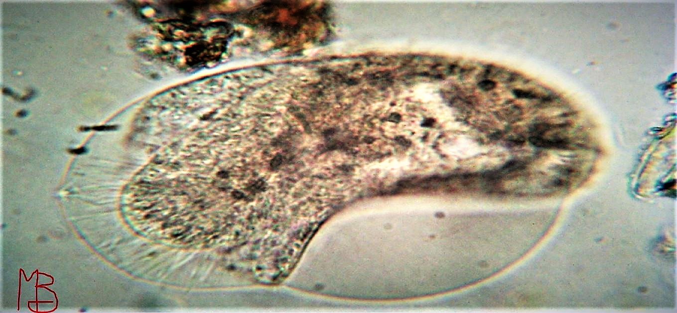 Ciliato da determinare